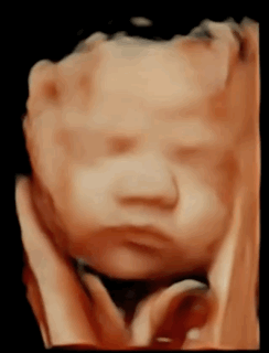 4D Animated Image of Baby via Sonography San.